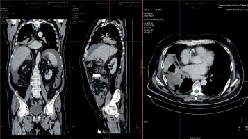 https://www.archivesofmedicalscience.com/f/fulltexts/170963/AMS-19-5-170963-g002_min.jpg