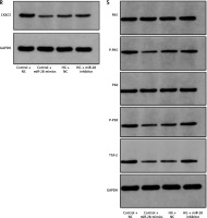 https://www.archivesofmedicalscience.com/f/fulltexts/171024/AMS-21-3-171024-g002_min.jpg