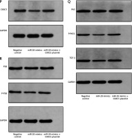 https://www.archivesofmedicalscience.com/f/fulltexts/171024/AMS-21-3-171024-g004_min.jpg