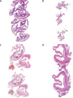 https://www.archivesofmedicalscience.com/f/fulltexts/171350/AMS-21-2-171350-g001_min.jpg
