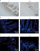 https://www.archivesofmedicalscience.com/f/fulltexts/171752/AMS-21-3-171752-g001_min.jpg