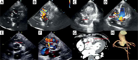 https://www.archivesofmedicalscience.com/f/fulltexts/172098/AMS-19-6-172098-g001_min.jpg