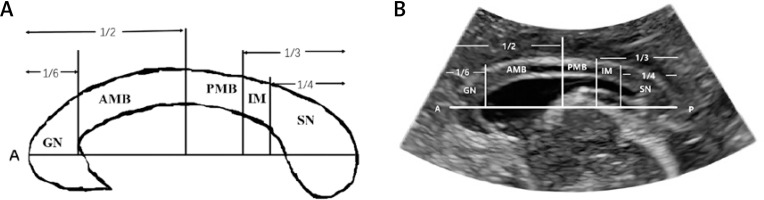https://www.archivesofmedicalscience.com/f/fulltexts/178184/AMS-21-4-178184-g001_min.jpg