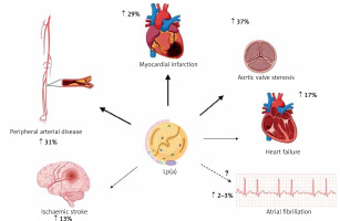 https://www.archivesofmedicalscience.com/f/fulltexts/183522/AMS-20-1-183522-g002_min.jpg