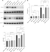 https://www.archivesofmedicalscience.com/f/fulltexts/192051/AMS-21-4-192051-g016_min.jpg