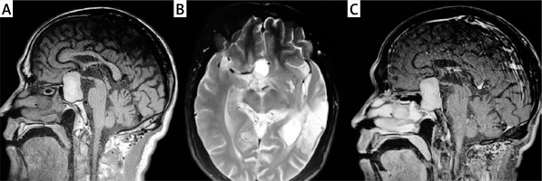 https://www.archivesofmedicalscience.com/f/fulltexts/201450/AMS-21-1-201450-g001_min.jpg