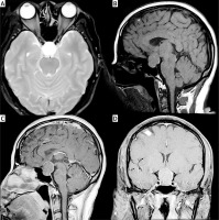https://www.archivesofmedicalscience.com/f/fulltexts/201450/AMS-21-1-201450-g002_min.jpg