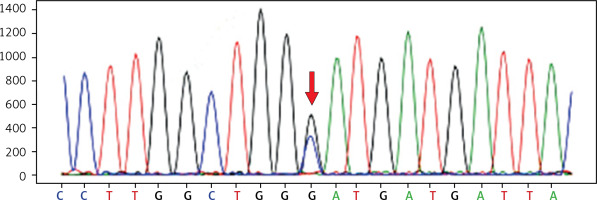 https://www.archivesofmedicalscience.com/f/fulltexts/202433/AMS-21-1-202433-g003_min.jpg
