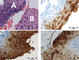 https://www.archivesofmedicalscience.com/f/fulltexts/204809/AMS-21-3-204809-g001_min.jpg