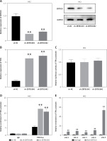 https://www.archivesofmedicalscience.com/f/fulltexts/204810/AMS-22-1-204810-g005_min.jpg