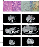 https://www.archivesofmedicalscience.com/f/fulltexts/205520/AMS-22-3-205520-g006_min.jpg