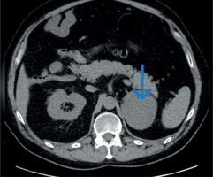 https://www.archivesofmedicalscience.com/f/fulltexts/207059/AMS-21-3-207059-g001_min.jpg