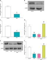 https://www.archivesofmedicalscience.com/f/fulltexts/207429/AMS-22-2-207429-g003_min.jpg