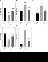 https://www.archivesofmedicalscience.com/f/fulltexts/207708/AMS-22-1-207708-g002_min.jpg