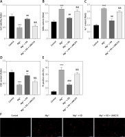 https://www.archivesofmedicalscience.com/f/fulltexts/207708/AMS-22-1-207708-g004_min.jpg