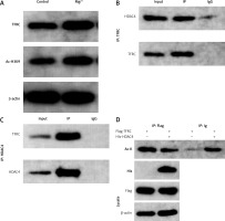 https://www.archivesofmedicalscience.com/f/fulltexts/207708/AMS-22-1-207708-g005_min.jpg