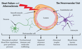 https://www.archivesofmedicalscience.com/f/fulltexts/208372/AMS-21-4-208372-g002_min.jpg