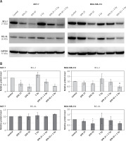 https://www.archivesofmedicalscience.com/f/fulltexts/208378/AMS-22-4-208378-g006_min.jpg