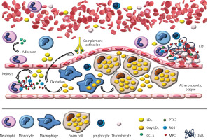 https://www.archivesofmedicalscience.com/f/fulltexts/213753/AMS-22-3-213753-g001_min.jpg