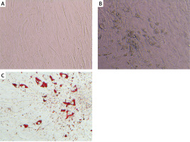 https://www.archivesofmedicalscience.com/f/fulltexts/214730/AMS-22-2-214730-g002_min.jpg