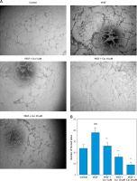 https://www.archivesofmedicalscience.com/f/fulltexts/215559/AMS-22-2-215559-g002_min.jpg