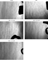 https://www.archivesofmedicalscience.com/f/fulltexts/215559/AMS-22-2-215559-g003_min.jpg