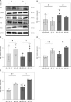 https://www.archivesofmedicalscience.com/f/fulltexts/216654/AMS-22-4-216654-g003_min.jpg