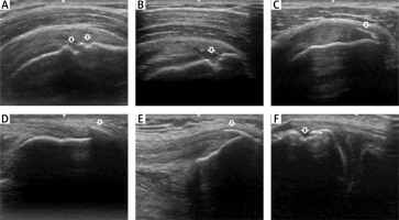 https://www.archivesofmedicalscience.com/f/fulltexts/217517/AMS-22-4-217517-g001_min.jpg