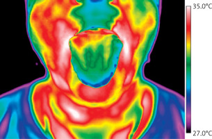 https://www.archivesofmedicalscience.com/f/fulltexts/218009/AMS-22-3-218009-g002_min.jpg