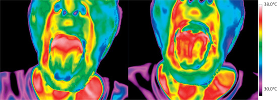 https://www.archivesofmedicalscience.com/f/fulltexts/218009/AMS-22-3-218009-g004_min.jpg