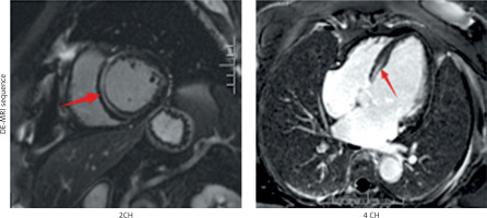 https://www.archivesofmedicalscience.com/f/fulltexts/219140/AMS-22-1-219140-g001_min.jpg