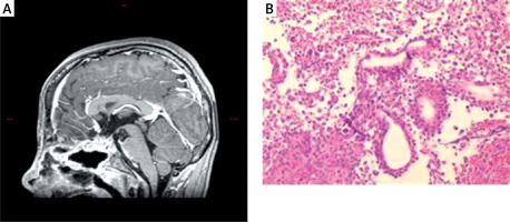 https://www.archivesofmedicalscience.com/f/fulltexts/224312/AMS-22-3-224312-g002_min.jpg
