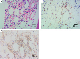 https://www.archivesofmedicalscience.com/f/fulltexts/226402/AMS-22-4-226402-g001_min.jpg