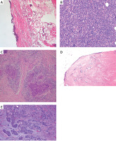 https://www.archivesofmedicalscience.com/f/fulltexts/226688/AMS-22-4-226688-g001_min.jpg