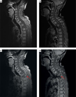 https://www.archivesofmedicalscience.com/f/fulltexts/230992/AMS-22-4-230992-g001_min.jpg