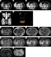 https://www.archivesofmedicalscience.com/f/fulltexts/235877/AMS-22-4-235877-g001_min.jpg