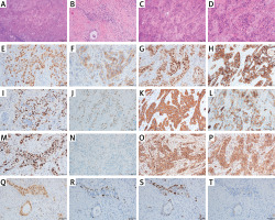 https://www.archivesofmedicalscience.com/f/fulltexts/235877/AMS-22-4-235877-g002_min.jpg