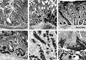 https://www.archivesofmedicalscience.com/f/fulltexts/52939/AMS-16-6-21253-g001_min.jpg