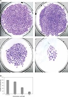 https://www.archivesofmedicalscience.com/f/fulltexts/66117/AMS-15-34070-g003_min.jpg