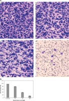 https://www.archivesofmedicalscience.com/f/fulltexts/66117/AMS-15-34070-g006_min.jpg