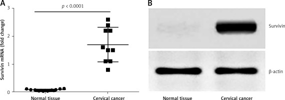 https://www.archivesofmedicalscience.com/f/fulltexts/67308/AMS-15-30893-g001_min.jpg