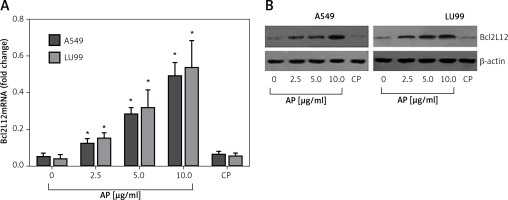 https://www.archivesofmedicalscience.com/f/fulltexts/68997/AMS-15-37341-g001_min.jpg