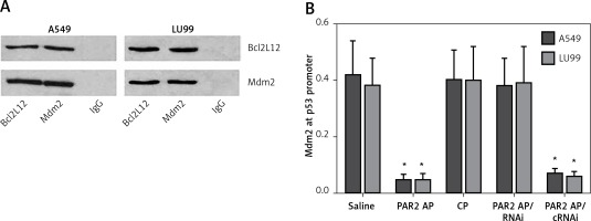 https://www.archivesofmedicalscience.com/f/fulltexts/68997/AMS-15-37341-g003_min.jpg