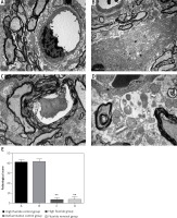 https://www.archivesofmedicalscience.com/f/fulltexts/69040/AMS-15-35962-g002_min.jpg