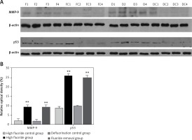 https://www.archivesofmedicalscience.com/f/fulltexts/69040/AMS-15-35962-g005_min.jpg