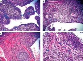 https://www.archivesofmedicalscience.com/f/fulltexts/70005/AMS-15-31364-g005_min.jpg