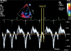 https://www.archivesofmedicalscience.com/f/fulltexts/70073/AMS-15-35766-g002_min.jpg