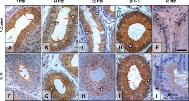 https://www.archivesofmedicalscience.com/f/fulltexts/70233/AMS-15-30141-g008_min.jpg