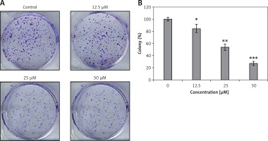 https://www.archivesofmedicalscience.com/f/fulltexts/70349/AMS-15-33898-g002_min.jpg