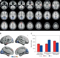 https://www.archivesofmedicalscience.com/f/fulltexts/73917/AMS-15-37404-g001_min.jpg